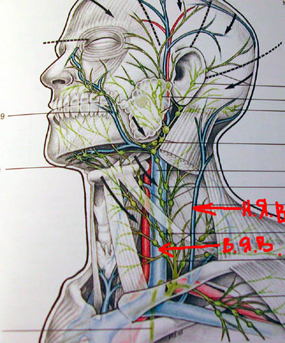Яремная вена картина. Наружная яремная Вена лимфоузлы. Брахеоцефальная зона яремная Вена.
